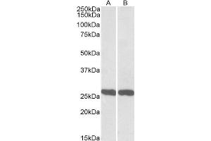 ABIN571207 (0. (UCHL1 抗体  (AA 211-221))