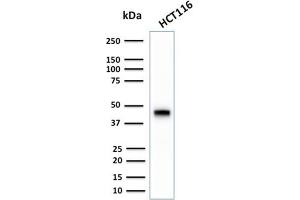 Western Blotting (WB) image for anti-Keratin 18 (KRT18) antibody (ABIN6939938)