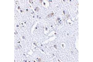 Immunohistochemistry of TIGAR in human brain tissue with TIGAAP30878PU-N at 2. (TIGAR 抗体  (Center))