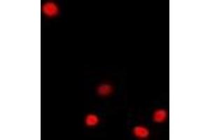Immunofluorescent analysis of Dnmt3L staining in A549 cells. (DNMT3L 抗体)