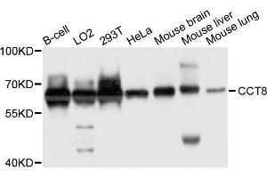 Western blot analysis of extract of various cells, using CCT8 antibody. (CCT8 抗体)