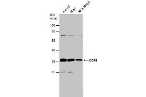 WB Image Various whole cell extracts (30 μg) were separated by 10% SDS-PAGE, and the membrane was blotted with CCR5 antibody , diluted at 1:500. (CCR5 抗体  (Center))