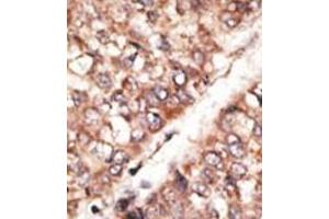 Image no. 1 for anti-Bone Morphogenetic Protein 3 (BMP3) (N-Term) antibody (ABIN357181) (BMP3 抗体  (N-Term))