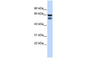 GALNT4 antibody used at 1 ug/ml to detect target protein. (GALNT4 抗体)