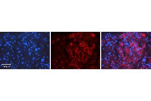 Rabbit Anti-ID2 Antibody   Formalin Fixed Paraffin Embedded Tissue: Human Liver Tissue Observed Staining: Cytoplasm Primary Antibody Concentration: 1:100 Other Working Concentrations: 1:600 Secondary Antibody: Donkey anti-Rabbit-Cy3 Secondary Antibody Concentration: 1:200 Magnification: 20X Exposure Time: 0. (Id2 抗体  (Middle Region))