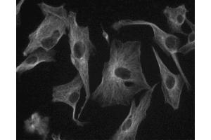 Immunofluorescent staining of U-87 MG (ATCC HTB-14) cells. (TUBB 抗体)