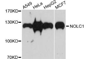 Western blot analysis of extracts of various cells, using NOLC1 antibody. (NOLC1 抗体)