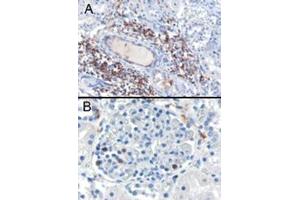 Image no. 1 for anti-SH3-Domain Binding Protein 1 (SH3BP1) (C-Term) antibody (ABIN374404) (SH3BP1 抗体  (C-Term))