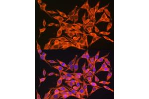 Immunofluorescence analysis of HeLa cells using MT- antibody (ABIN7268594) at dilution of 1:100. (Mitochondrially Encoded ATP Synthase 8 (MT-ATP8) 抗体)