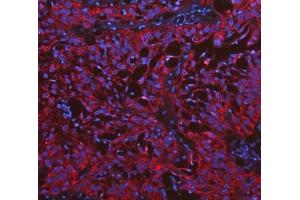 IF analysis of Cytokeratin 19 using anti-Cytokeratin 19 antibody (ABIN3043288). (Cytokeratin 19 抗体  (C-Term))