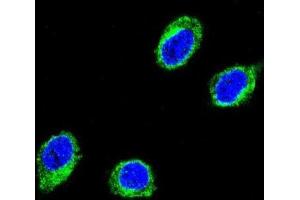 Immunofluorescence (IF) image for anti-Coiled-Coil alpha-Helical Rod Protein 1 (CCHCR1) antibody (ABIN3003788) (CCHCR1 抗体)