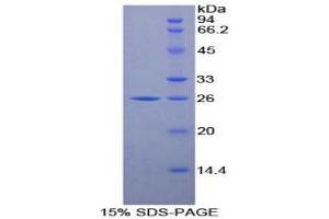 SDS-PAGE (SDS) image for Proteasome (Prosome, Macropain) Subunit, beta Type, 8 (Large Multifunctional Peptidase 7) (PSMB8) protein (ABIN3010425)