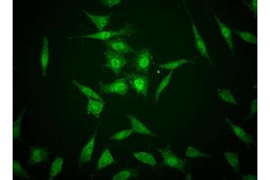 Immunofluorescent staining of human cell lines. (TAZ 抗体)
