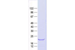 Western Blotting (WB) image for C-Type Lectin Domain Family 7, Member A (CLEC7A) protein (His tag) (ABIN2712871)