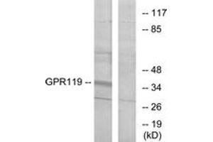 Western blot analysis of extracts from K562 cells, using GPR119 Antibody. (G Protein-Coupled Receptor 119 抗体  (AA 186-235))