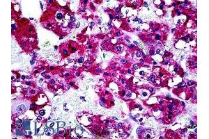 Immunohistochemistry (IHC) image for anti-Tyrosine-Protein Phosphatase Non-Receptor Type 22 (PTPN22) (Internal Region) antibody (ABIN6391380)