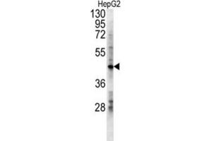 Western Blotting (WB) image for anti-Lactate Dehydrogenase D (LDHD) antibody (ABIN3002427) (LDHD 抗体)