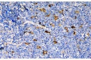 IHC analysis of CCR6 using anti-CCR6 antibody (ABIN7603110). (CCR6 抗体  (N-Term))