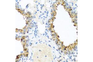 Immunohistochemistry of paraffin-embedded mouse lung using NIN antibody at dilution of 1:100 (x40 lens). (Ninein 抗体)