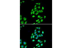 Immunofluorescence analysis of HeLa cells using NFS1 antibody (ABIN6130224, ABIN6144594, ABIN6144596 and ABIN6217361). (NFS1 抗体  (AA 208-457))