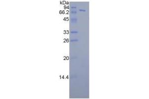SDS-PAGE analysis of Human FKBP5 Protein. (FKBP5 蛋白)