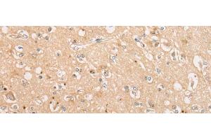 Immunohistochemistry of paraffin-embedded Human brain tissue using C15orf40 Polyclonal Antibody at dilution of 1:30(x200) (C15orf40 抗体)