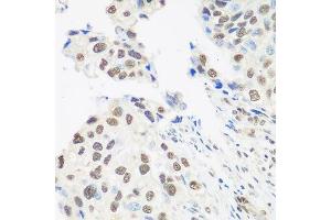 Immunohistochemistry (Paraffin-embedded Sections) (IHC (p)) image for anti-DEAD (Asp-Glu-Ala-Asp) Box Polypeptide 39B (DDX39B) (AA 319-428) antibody (ABIN6139492)