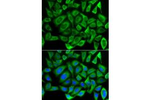 Immunofluorescence analysis of A-549 cells using CYCS antibody.