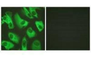 Immunofluorescence analysis of HeLa cells, using Kir5. (KIR5.1 抗体)