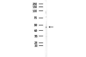 anti-Plasminogen Activator Inhibitor 2 (SERPINB2) (Internal Region) antibody