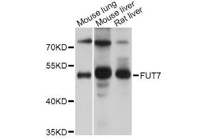 Western blot analysis of extracts of various cell lines, using FUT7 Antibody (ABIN5995907) at 1/1000 dilution. (FUT7 抗体)