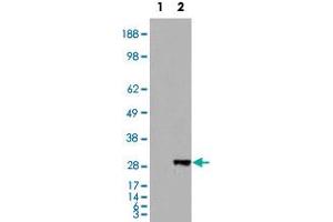 HEK293 overexpressing BDH2 and probed with BDH2 polyclonal antibody  (mock transfection in first lane), tested by Origene. (BDH2 抗体  (Internal Region))