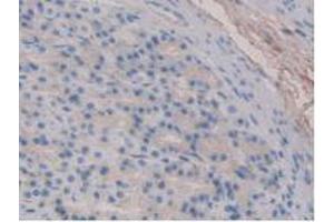 IHC-P analysis of Rat Stomach Tissue, with DAB staining. (Fibrillin 1 抗体  (AA 751-895))