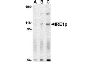 Western blot analysis of IRE1p in A-20 cell lysate with AP30445PU-N IRE1p antibody at (A) 0. (ERN1 抗体  (N-Term))