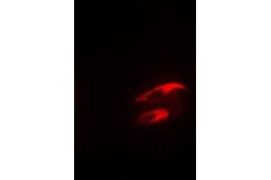 Immunofluorescent analysis of Focal Adhesion Kinase (pY925) staining in NIH3T3 cells. (FAK 抗体  (C-Term, pTyr925))