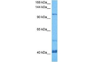 Host:  Mouse  Target Name:  KIF23  Sample Tissue:  Mouse Spleen  Antibody Dilution:  1ug/ml (KIF23 抗体  (Middle Region))