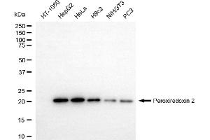 Western blotting analysis using peroxiredoxin 2 antibody (ABIN7799777).