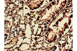 Immunohistochemistry of paraffin-embedded human appendix tissue using ABIN7142858 at dilution of 1:100 (NUDT1 抗体  (AA 49-82))