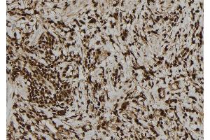ABIN6277757 at 1/100 staining Human gastric tissue by IHC-P. (PVALB 抗体  (C-Term))