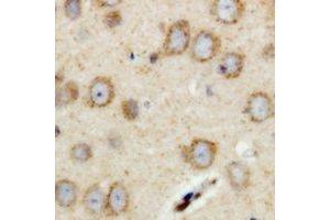 Immunohistochemical analysis of RIMS4 staining in human brain formalin fixed paraffin embedded tissue section. (RIMS4 抗体)