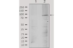 Western blot analysis of extracts from mouse brain, using TM16J Antibody. (ANO9 抗体  (Internal Region))