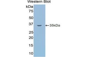 Detection of Recombinant LSR, Human using Monoclonal Antibody to Lipolysis Stimulated Lipoprotein Receptor (LSR) (LSR 抗体  (AA 335-589))