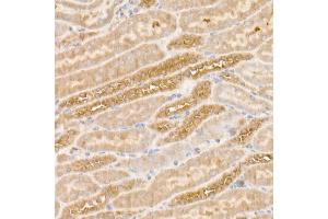Immunohistochemistry (IHC) image for anti-Sequestosome 1 (SQSTM1) antibody (ABIN7270205)