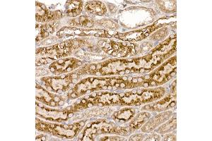 Immunohistochemistry (IHC) image for anti-Thioredoxin Domain Containing 12 (Endoplasmic Reticulum) (TXNDC12) antibody (ABIN7270799)
