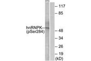 Western blot analysis of extracts from NIH-3T3 cells treated with EGF 200ng/ml 30', using hnRNP K (Phospho-Ser284) Antibody. (HNRNPK 抗体  (pSer284))