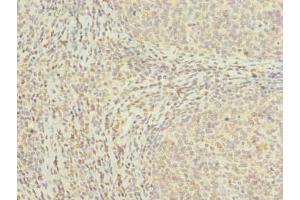 Immunohistochemistry of paraffin-embedded human tonsil tissue using ABIN7159116 at dilution of 1:100 (MED18 抗体  (AA 35-208))