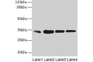 Western blot All lanes: RAD23A antibody at 3 μg/mL Lane 1: MCF-7 whole cell lysate Lane 2: Hela whole cell lysate Lane 3: Raji whole cell lysate Lane 4: Jurkat whole cell lysate Secondary Goat polyclonal to rabbit IgG at 1/10000 dilution Predicted band size: 40, 34 kDa Observed band size: 34 kDa (RAD23A 抗体  (AA 2-201))