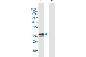 Western Blot analysis of RAB3B expression in transfected 293T cell line by RAB3B MaxPab polyclonal antibody. (RAB3B 抗体  (AA 1-219))