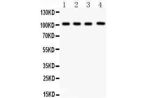Western Blotting (WB) image for anti-Neuropilin 1 (NRP1) (AA 504-827) antibody (ABIN3043584)