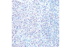 Immunohistochemistry of paraffin-embedded rat spleen using SNRPB Rabbit pAb (ABIN6134519, ABIN6148214, ABIN6148215 and ABIN6219175) at dilution of 1:100 (40x lens).